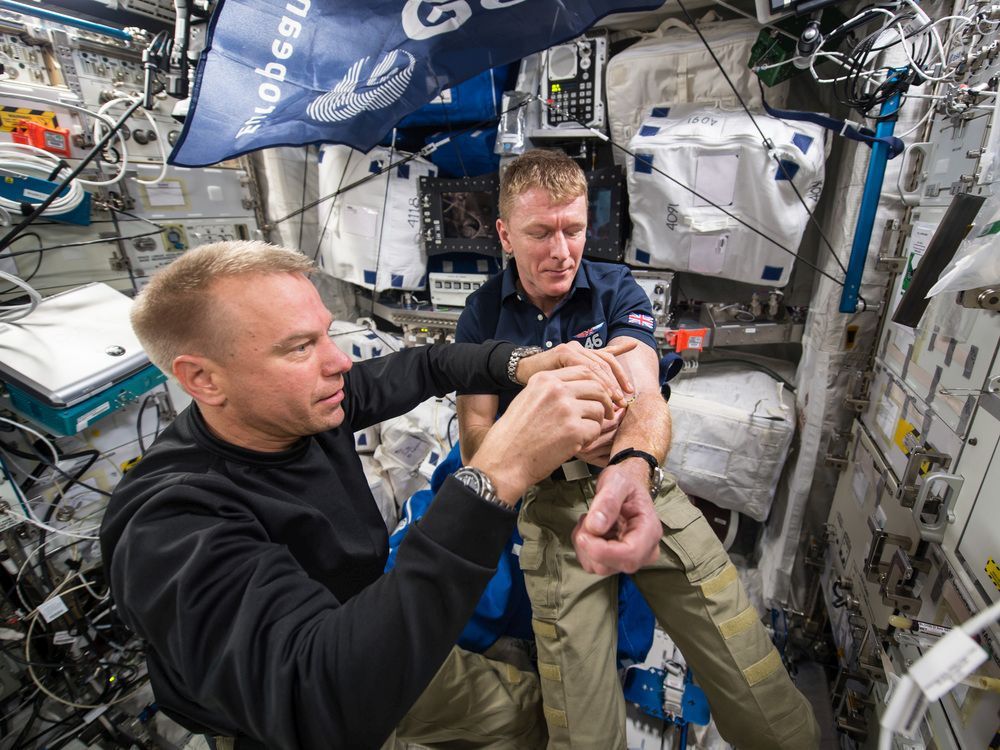 astronaut tim peake tweeted picture of his first blood draw completed in space. the sample was taken as part of the marrow investigation.