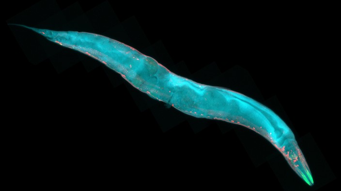 Researchers are using worms to figure out how humans can add years to their lives