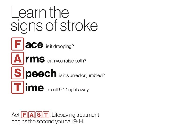  The Heart and Stroke Foundation of Canada recommends using the mnemonic FAST to remember the effects of a stroke or mini stroke.