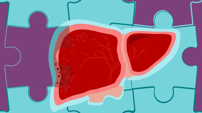 Uncovering the genetic causes of fatty liver disease — a growing health concern