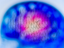 EEG with electrical activity of abnormal brain, electroencephalogram,EEG
