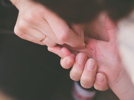 A splinter in the hand of a child. Girl pulls a splinter from the hands of a child.