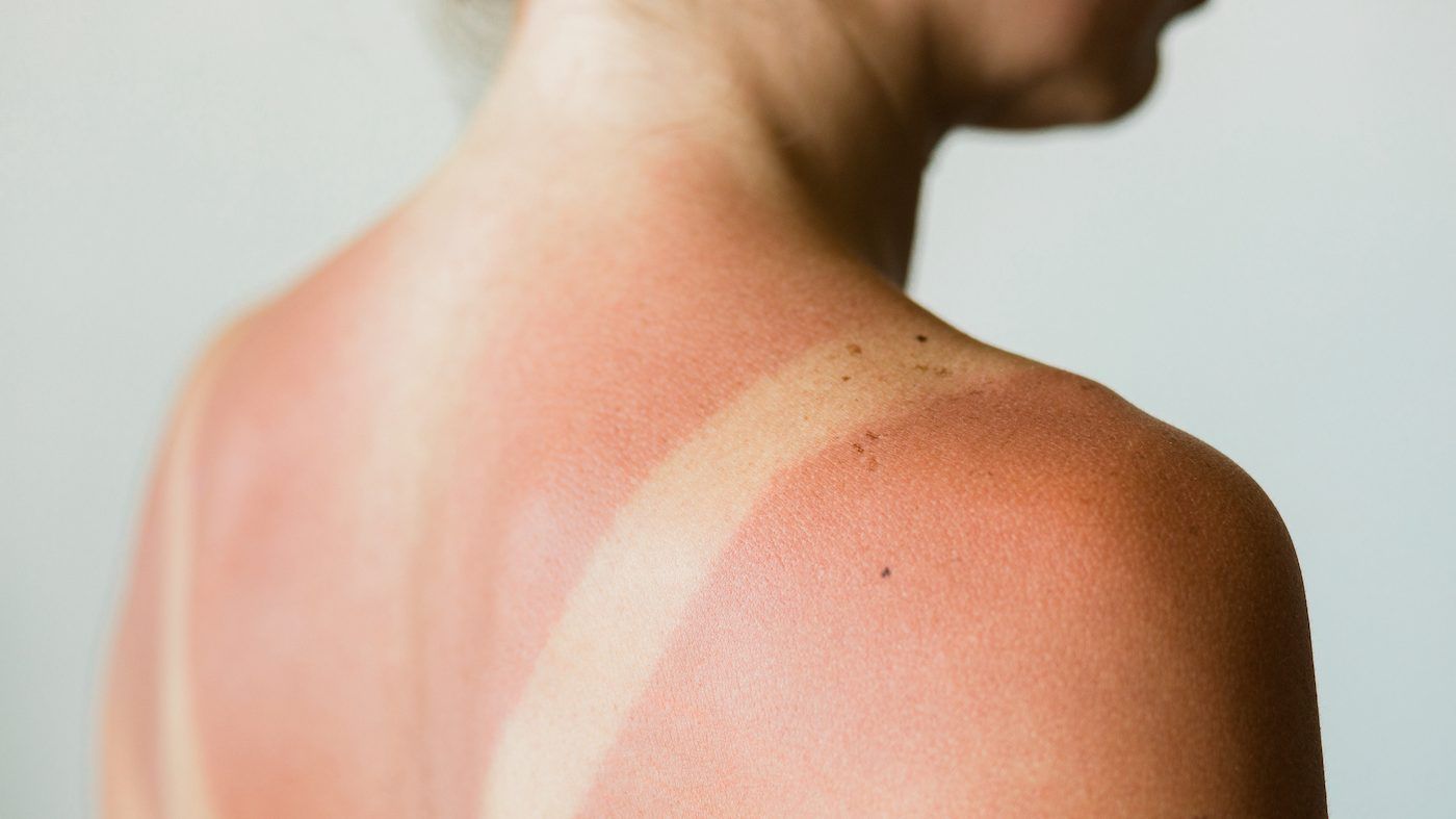 We know that the sun causes deadly skin cancer, so why are we still tanning?