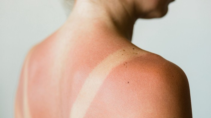 We know that the sun causes skin cancer, so why are we still tanning?