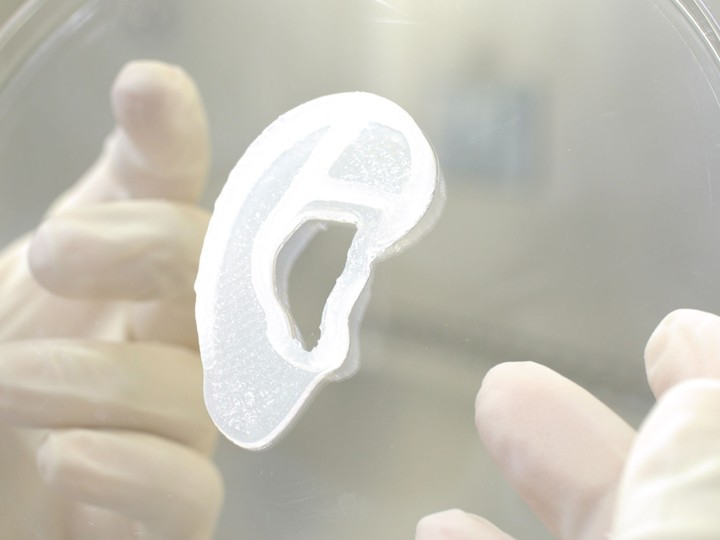  3D-printed ear transplant, courtesy of 3DBio Therapeutics.