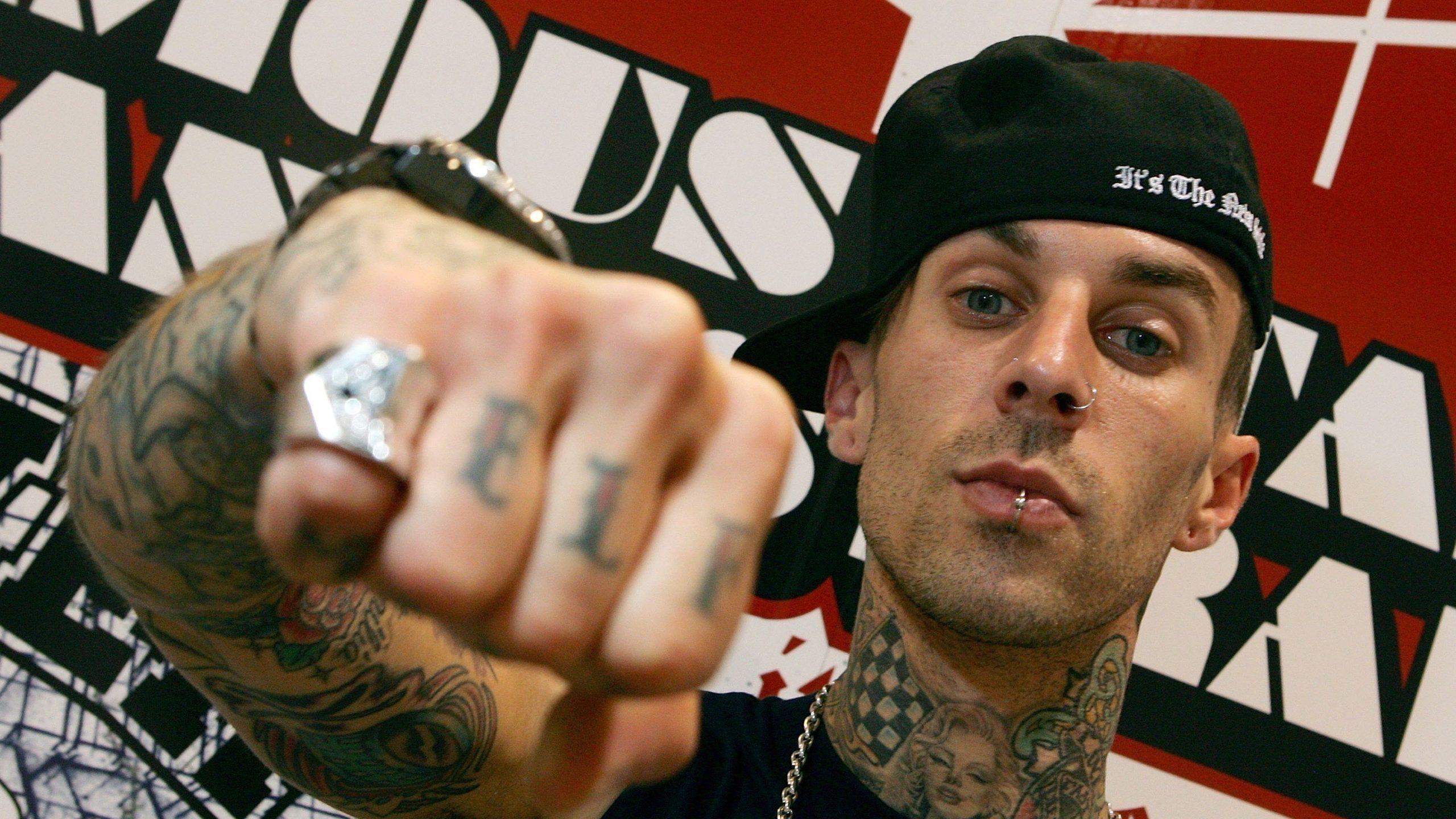 Travis Barker has put pancreatitis in the news. Here's what you should know about this potentially dangerous condition