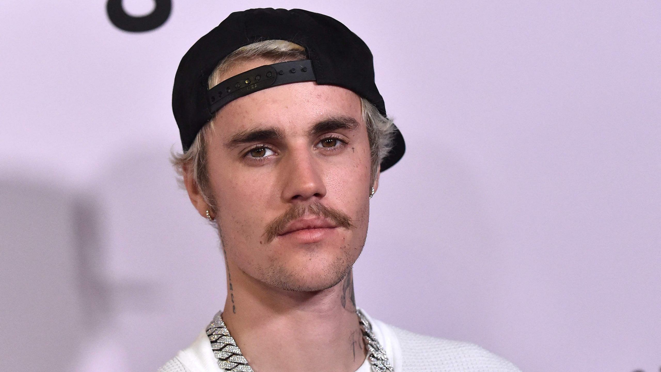 Justin Bieber 'did something very important for the facial difference community'