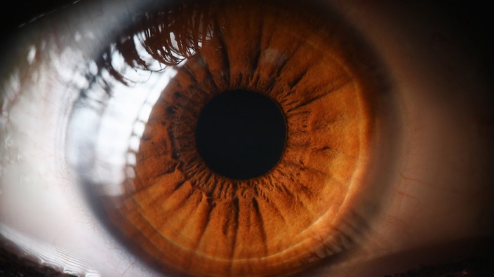 Can a routine eye test predict the risk of a heart attack?