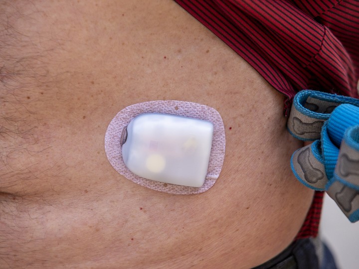  Andy Maarschalk wears his Omnipod under his shirt, saying it doesn’t restrict his lifestyle at all. Credit: Nick Kozak