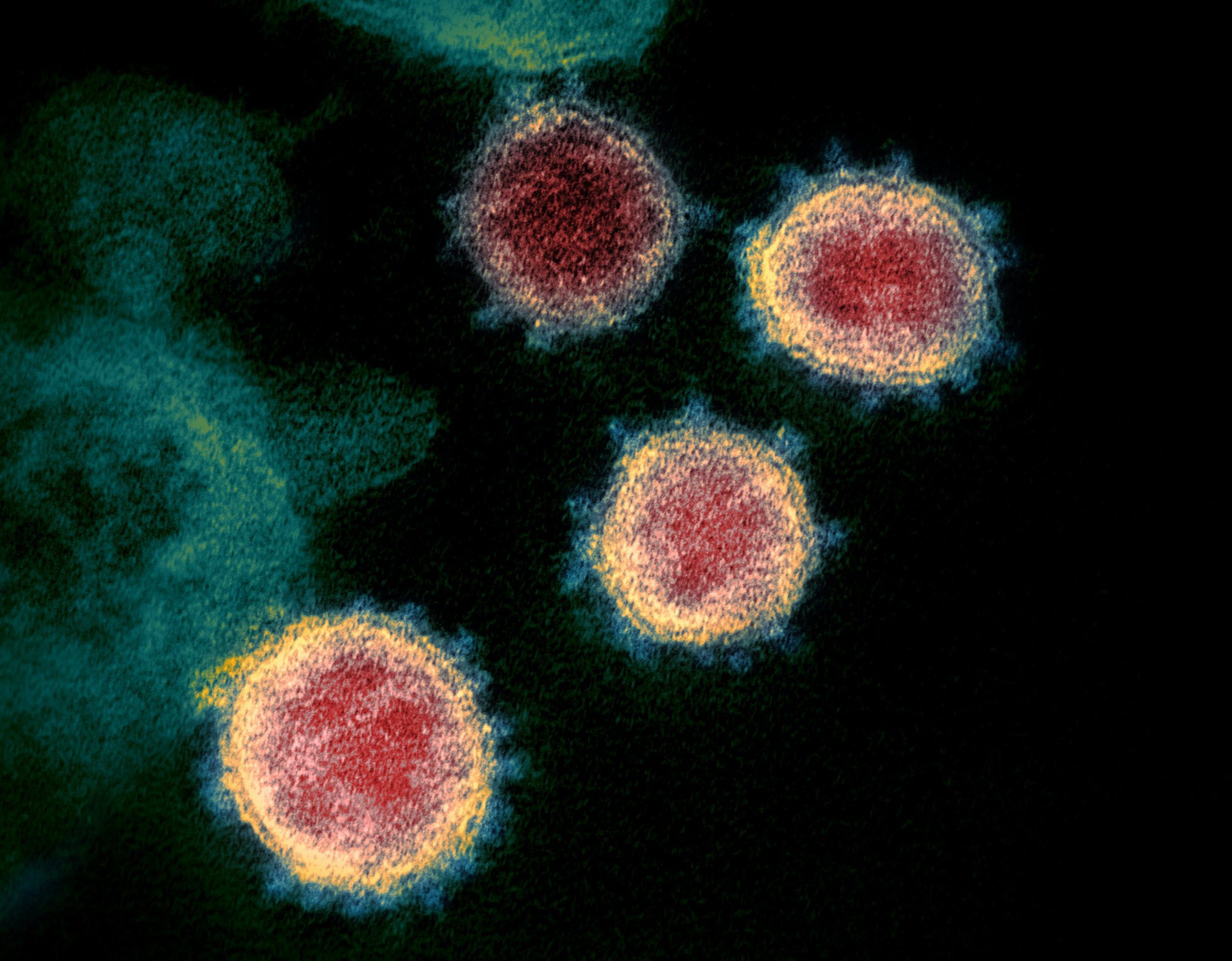 this undated electron microscope image made available by the u.s. national institutes of health in february 2020 shows the virus, isolated from a patient in the u.s. the canadian press/niaid-rml via ap