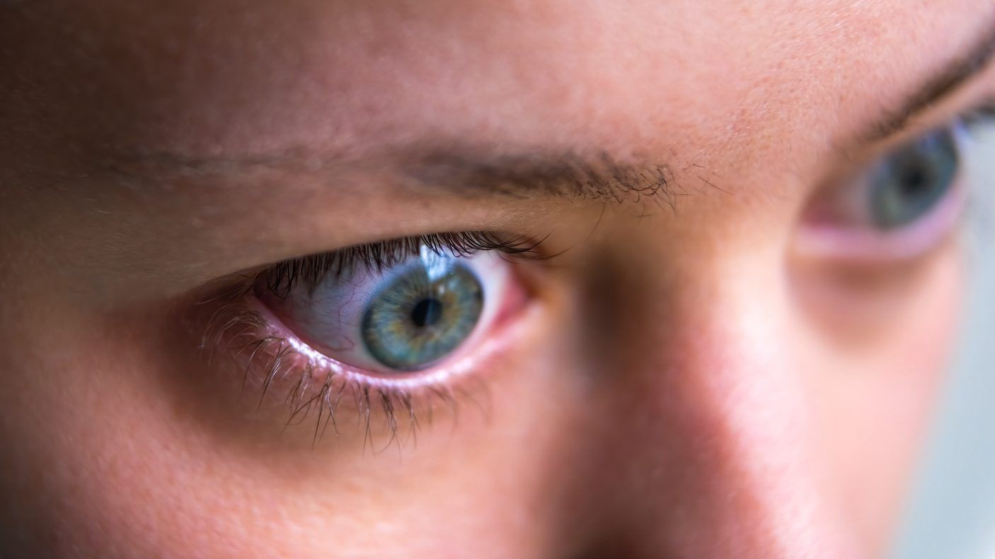 a common symptom of graves’ disease is bulging or inflamed eyes. getty