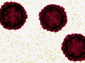 Polioviruses, electron microscope-like depiction