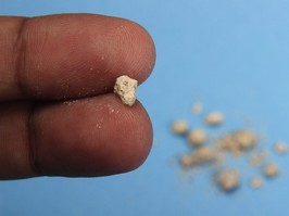 flat lay or top view very small kidney stone at two finger at blue background