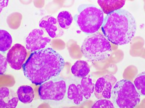 Chronic myeloid leukemia cells or CML