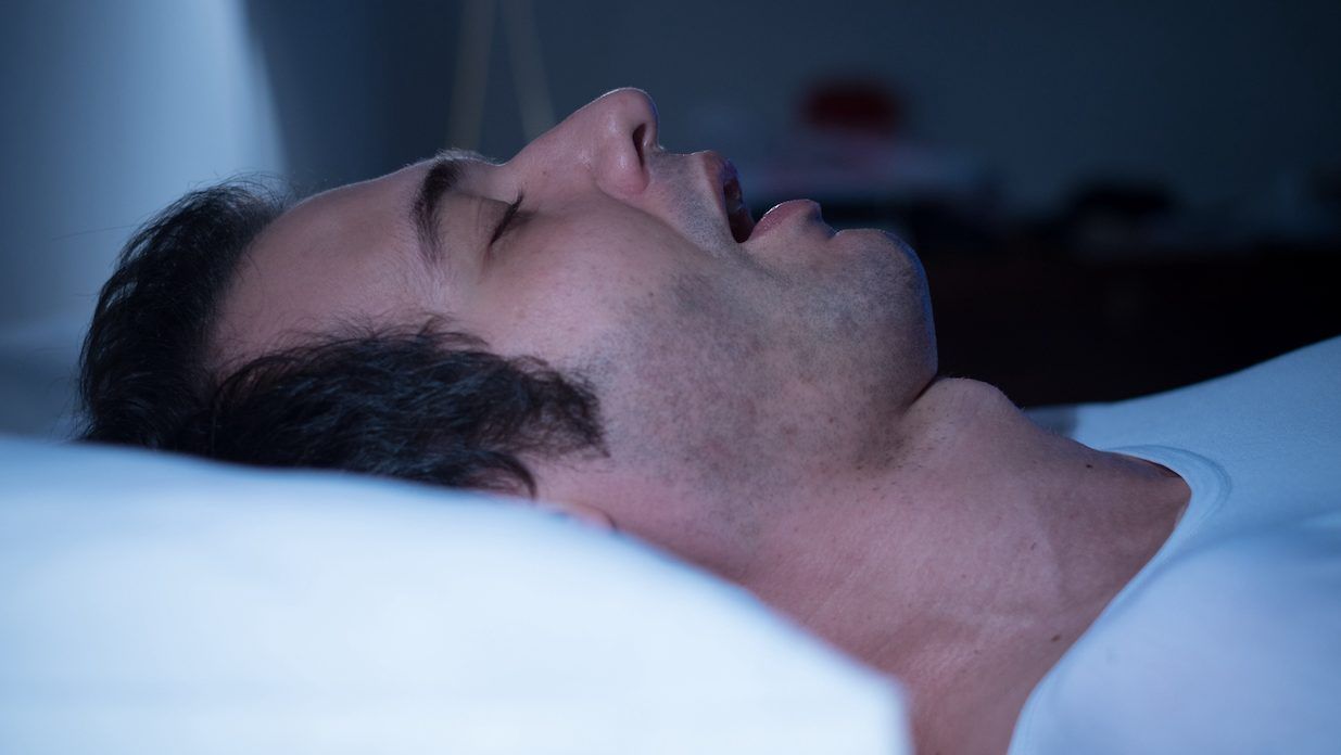 around 5.4 million canadians have either been diagnosed with sleep apnea or are at high risk, according to a 2014 study. getty