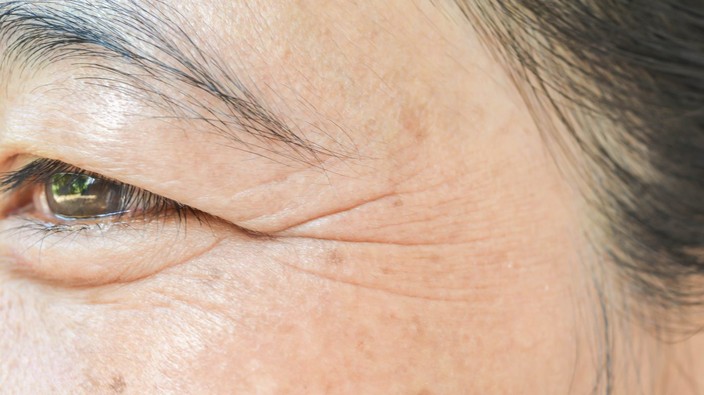 There are other ways to lessen the appearance of wrinkles