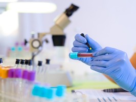 Woman working in a laboratory, writing with a felt pen.