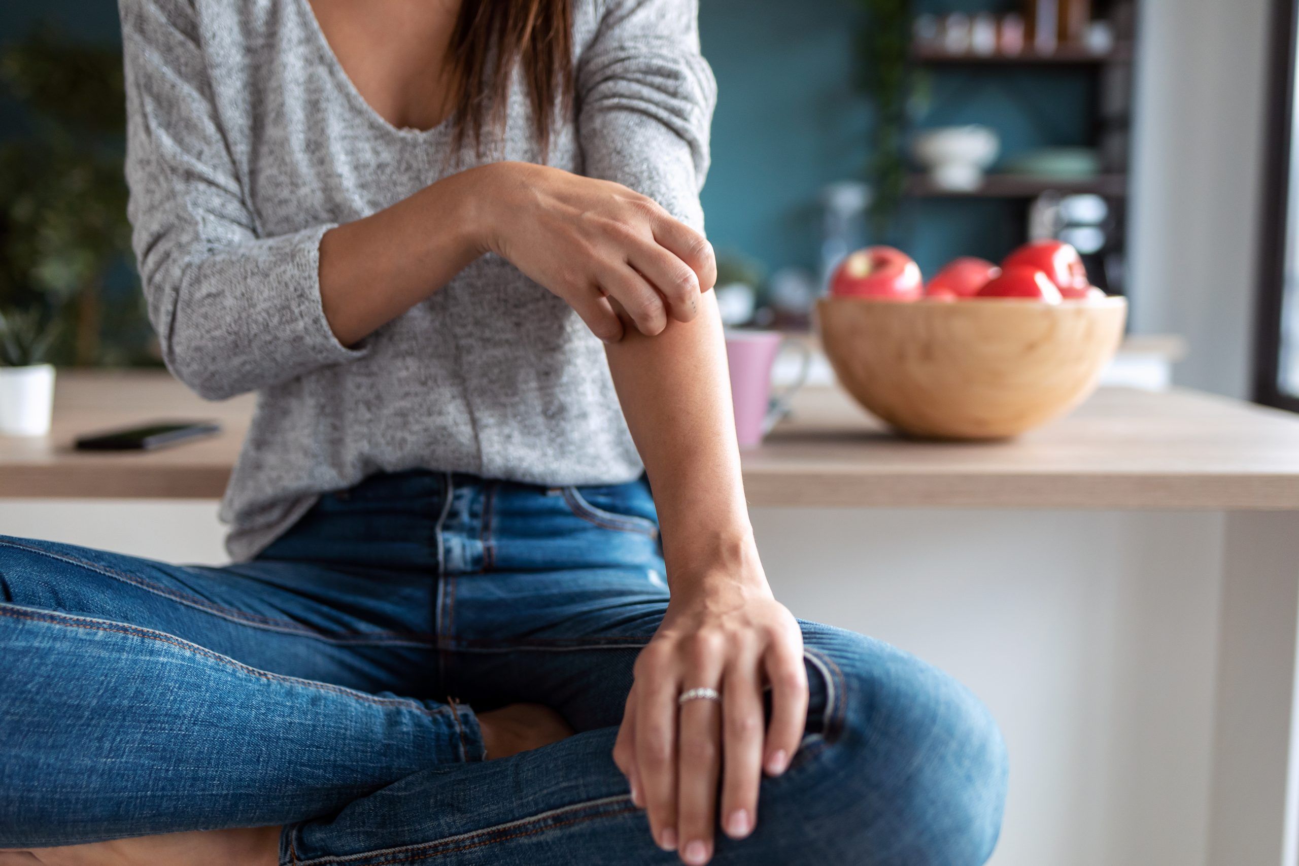 The impact of atopic dermatitis goes beyond “just an itch,” and can have profound effects on mental health, relationships and more. GETTY 