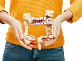 Treatment of CROHN'S DISEASE, flatulence, indigestion. Woman holds in front of her anatomical model of the colon, she has constipation and abdominal pain