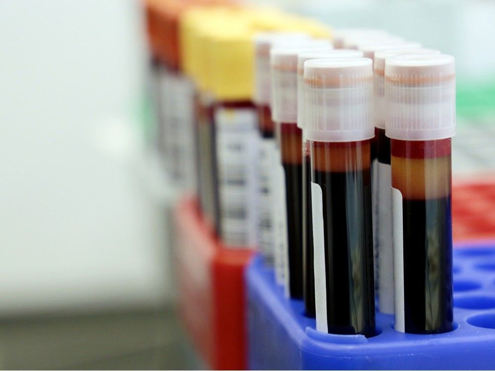 "the sum total of nearly 50 randomized trials comprising over 300,000 patients shows that cardiovascular benefit ties directly and linearly with the ldl or bad cholesterol in your blood: the lower the cholesterol, the better for your heart," dr. christopher labos writes.