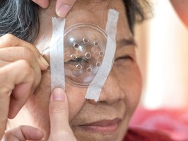 Cataract treatment after surgery by caregiver concept. Asia old woman placed protective shield over her eye taping the cover to protect during naps time.