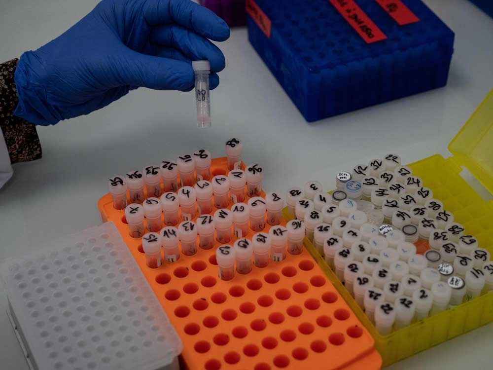 Researchers from the Auragen laboratory prepare the sequencing of human genomes to better identify rare diseases, in Lyon, France, on February 23, 2022.
