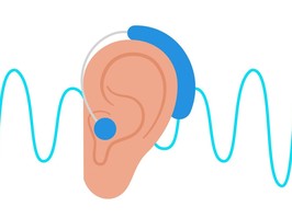 illustration of hearing aid