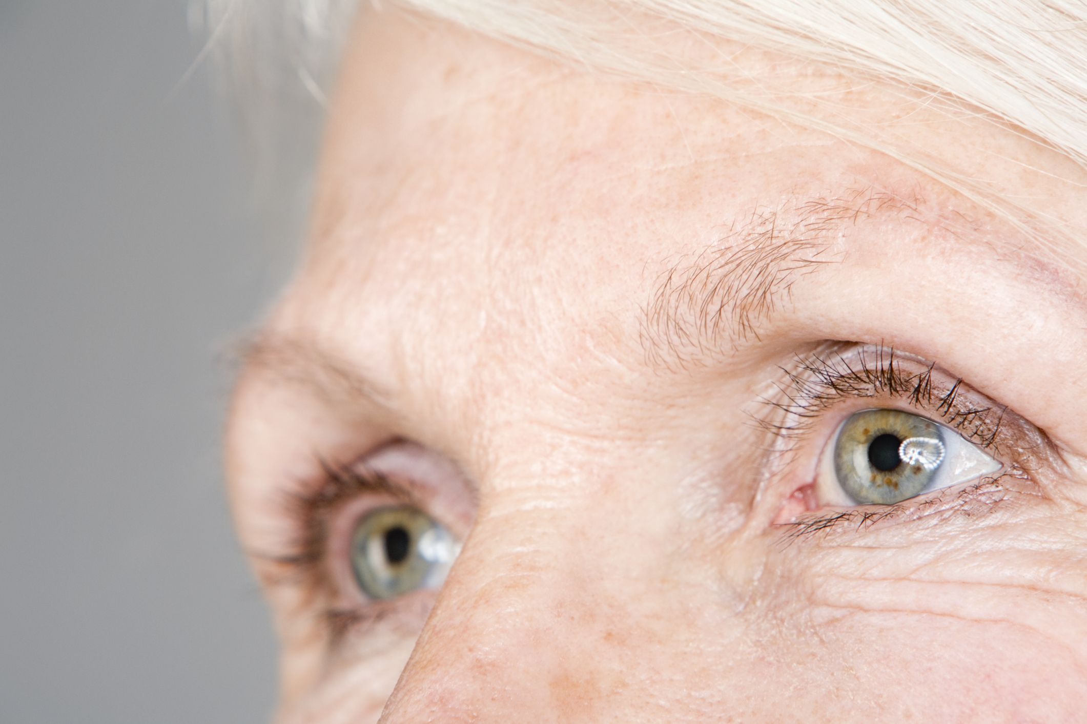 Age-related macular degeneration impacts 2.5 million Canadians over 55.