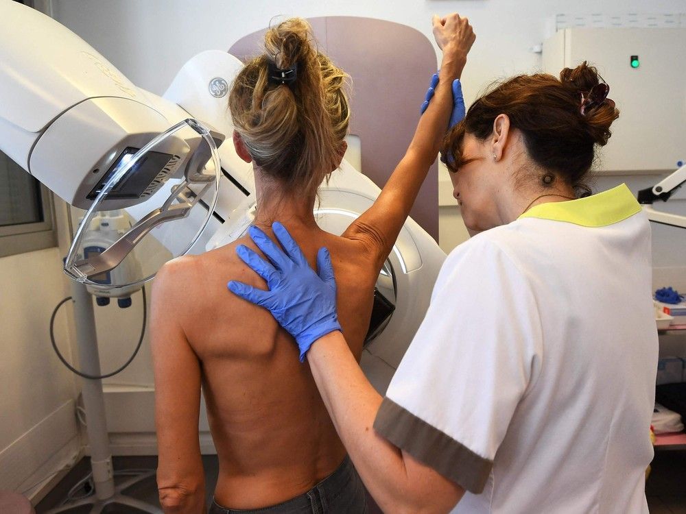 the collected data on mammography suggests it is very good at diagnosing breast cancer.