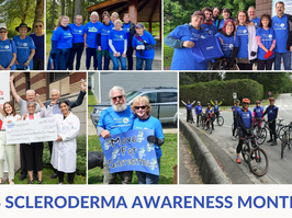 photos of scleroderma event