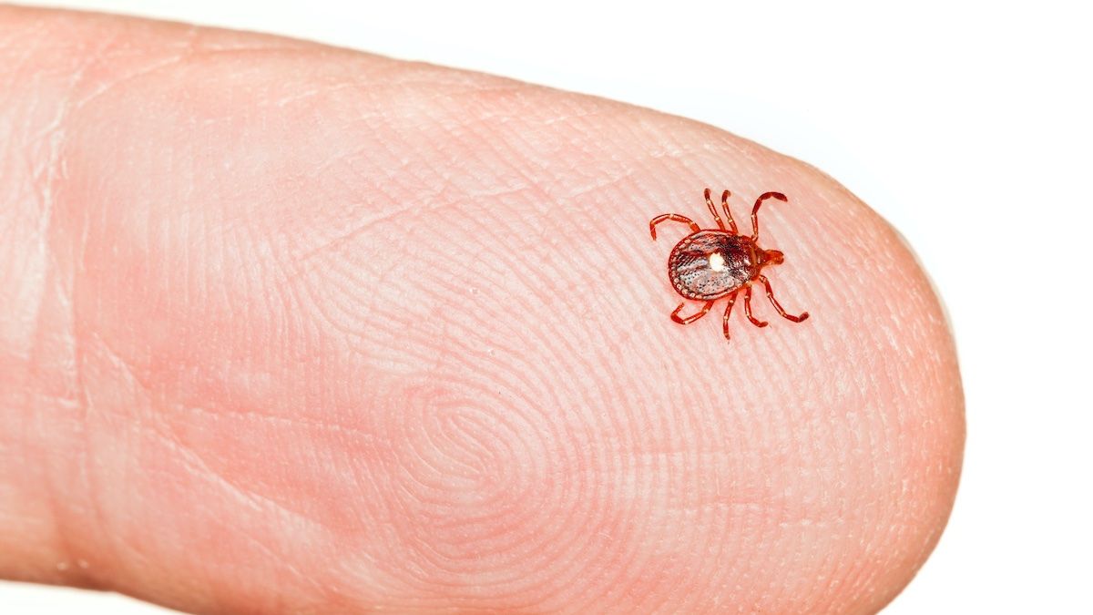 While alpha-gal syndrome is associated with a tick bite, patients may not notice symptoms until after they consume meat or dairy products, triggering the allergic reaction.