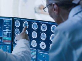 In Control Room Doctor and Radiologist Discuss Diagnosis while Watching Procedure and Monitors Showing Brain Scans Results, In the Background Patient Undergoes MRI or CT Scan Procedure.