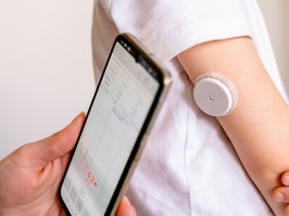 Medical device for glucose check. Continuous glucose monitoring pod.