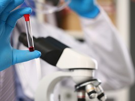 Male hand in blue protective gloves holding test tube with blood sample against background of microscope. Makes express analysis for aids in the presence of patient in hospice chemical laboratory