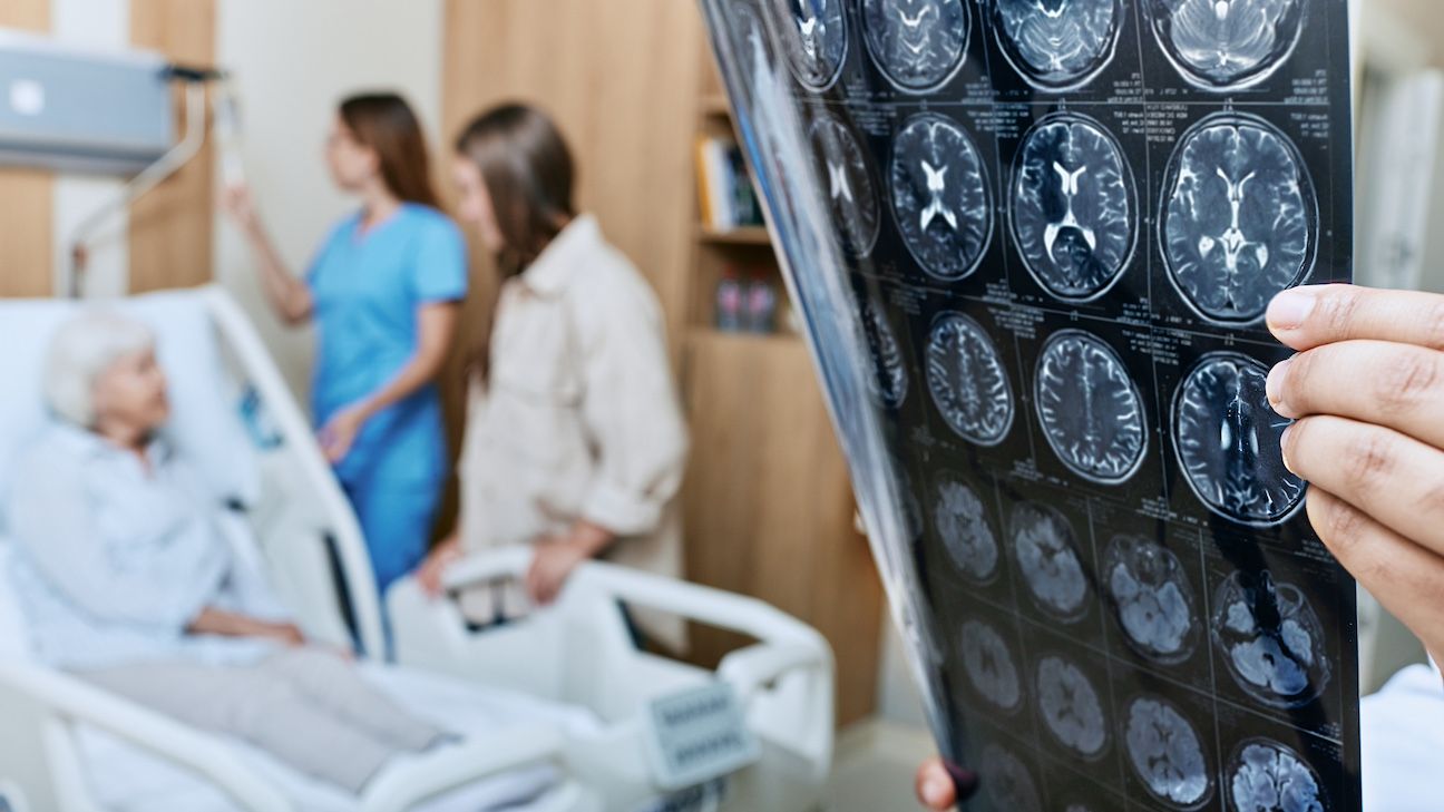 Ideally, a neurologist will lead your Parkinson's disease care team. Some patients may also be candidates for surgery to help with the motor complications of the disease.