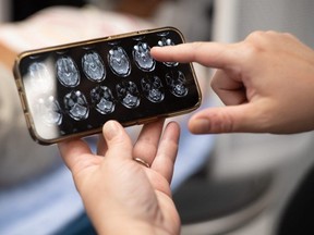 This portable MRI scanner can be controlled using a smartphone.