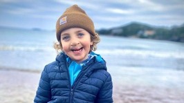 charlie gill was born with a bilateral cleft lip and palate and is in the early stages of orthodontic treatment.