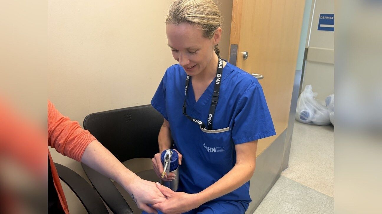 Nurse treats a patient wart on their hand.