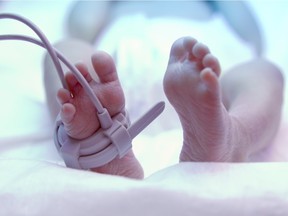 Local Input~ Feet of new born baby under ultraviolet lamp in the incubator.. Baby in hospital nursery  Credit: Fotolia  //0204 na opioids ORG XMIT: POS1602021242540901