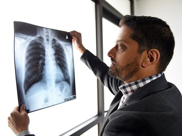 Radiologist Dr. Raj Patel looks over an x-ray at Radiology Associates of Regina.