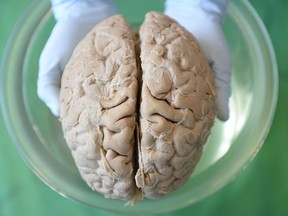 Anastasye Kisheev's hands hold a human brain at Science Rendezvous held at the University of Regina.
