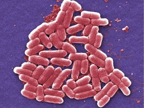 This 2006 colorized scanning electron micrograph image made available by the Centers for Disease Control and Prevention shows the O157:H7 strain of the E. coli bacteria. On Wednesday, May 26, 2016, U.S. military officials reported the first U.S. human case of bacteria resistant to an antibiotic used as a last resort drug. The 49-year-old woman has recovered from an infection of E. coli resistant to colistin. But officials fear that if the resistance spreads to other bacteria, the country may soon see germs impervious to all antibiotics. (Janice Carr/CDC via AP) ORG XMIT: NY400