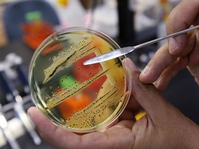 A doctor points out a growth of of salmonella in a petri dish at IEH Laboratories in Lake Forest Park, Wash., in this Monday, May 17, 2010 file photo. Two people have died after testing positive for salmonella during an outbreak of the bacterial infection at a personal care home in Winnipeg.