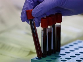Blood samples from volunteers are handled in the laboratory at Imperial College in London, Thursday, July 30, 2020.
