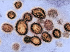 An electron microscope image shows SARS-CoV-2, the virus that causes COVID-19, as it emerges from cells cultured in the lab.