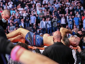 Chris Weidman leaves his fight against Uriah Hall on a stretcher after breaking his leg on a kick attempt during UFC 261 at VyStar Veterans Memorial Arena on April 24, 2021 in Jacksonville, Florida.