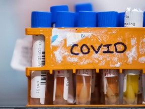 Specimens to be tested for COVID-19 are seen inside a laboratory.