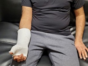 Yashdeep Shinde said he was in a cast for more than three months and a radiologist's report he shared with the National Post indicates he had a fracture of the scaphoid, a bone in the wrist.