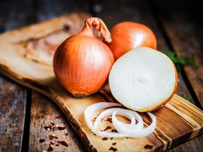 Onions are pictured in a file photo.