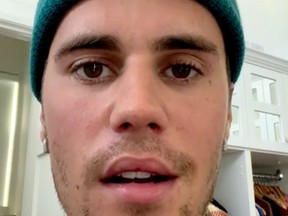 Justin Bieber - from his Instagram - 10 June 2022 - showing effects of facial paralysis